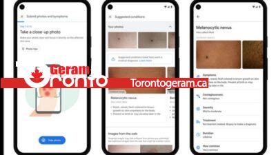 گوگل از هوش مصنوعی برای تشخیص بیماری‌های پوست رونمایی کرد
