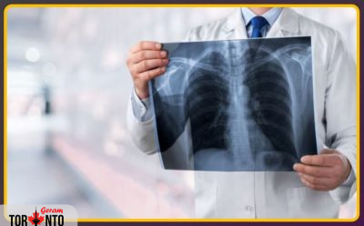 ذات‌الریه به ششمین علت اصلی مرگ در کانادا تبدیل شده است