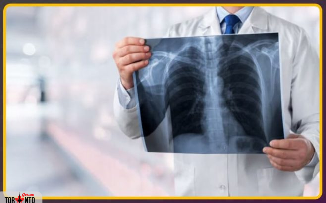 ذات‌الریه به ششمین علت اصلی مرگ در کانادا تبدیل شده است